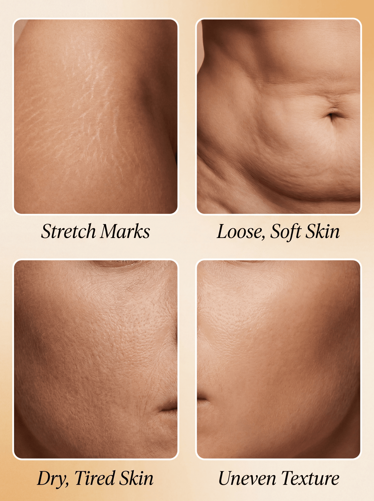 Lifetrack Golden Hour- Fast acting Cellulite Thermo firming Gel