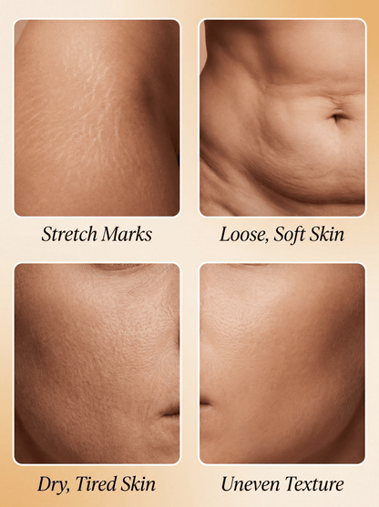 Lifetrack Golden Hour- Fast acting Cellulite Thermo firming Gel